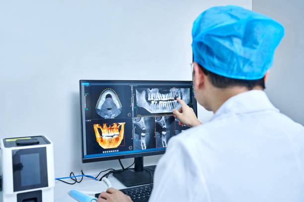 Best Emergency Dentist for Lost Fillings or Crowns in Wmette, IL